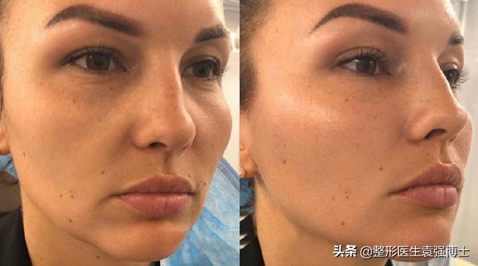 35岁了怎么改善松弛,35岁脸部紧致的10个训练