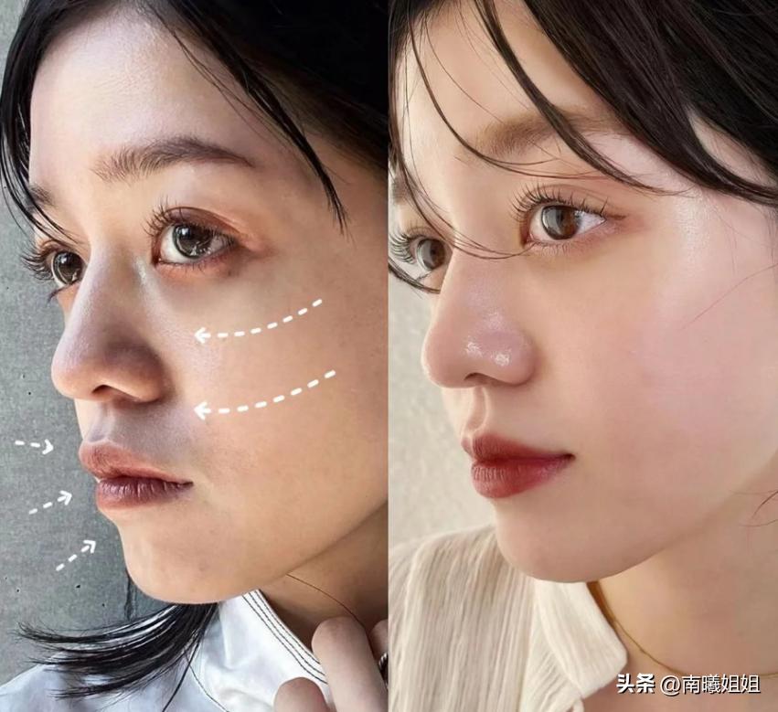 蒜头鼻却很漂亮的原因,蒜头鼻是真的影响颜值