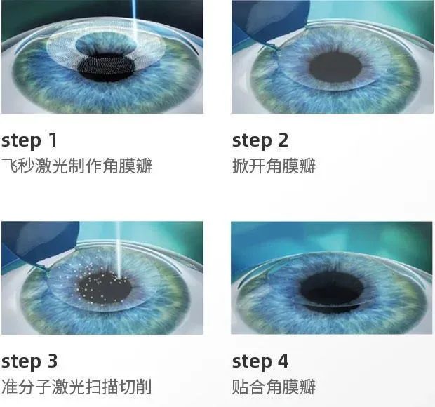 南开征兵体检矫正视力,征兵体检眼科沙眼