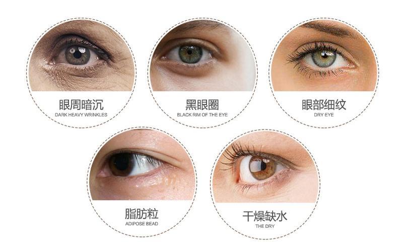 一双眼睛拯救一张脸你属哪种眼型,一双眼拯救一张脸眼型决定了颜值