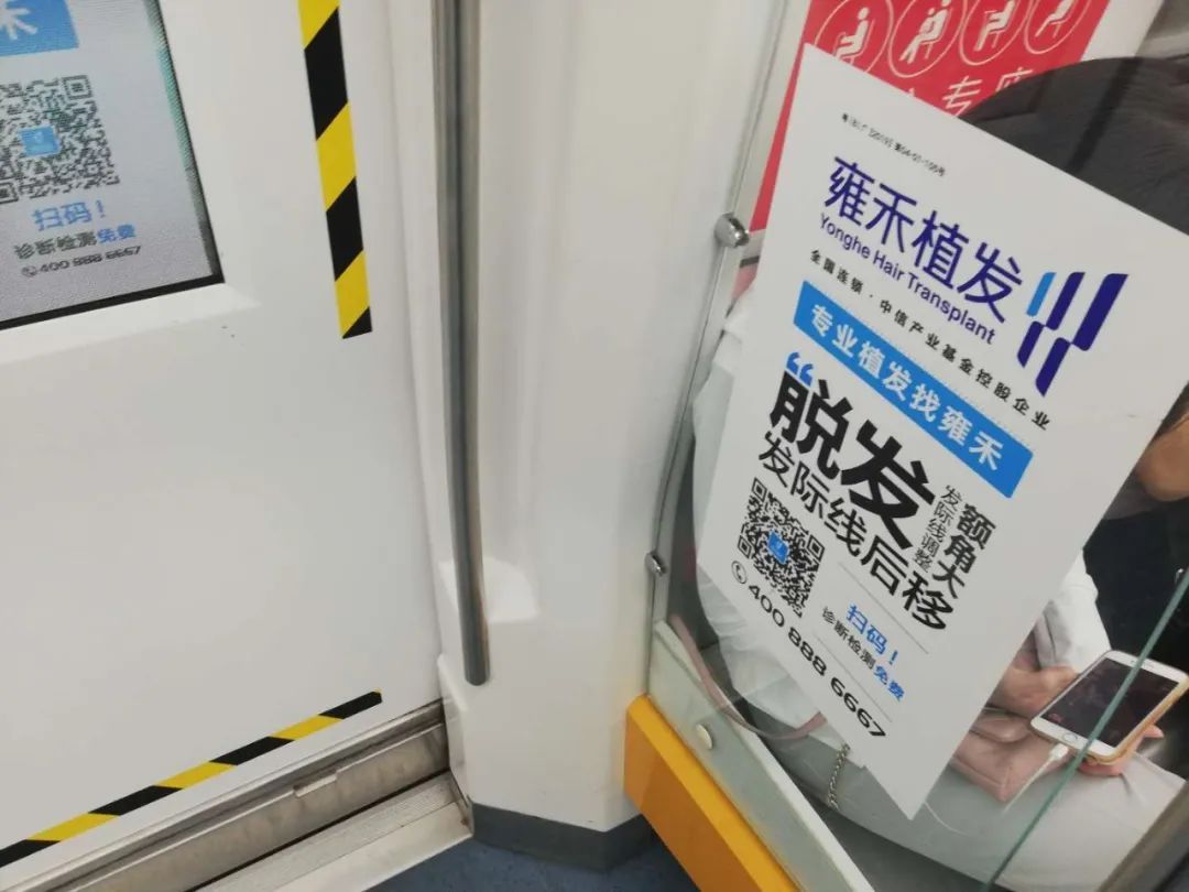 植发生意究竟有多暴利,植发暴不暴利