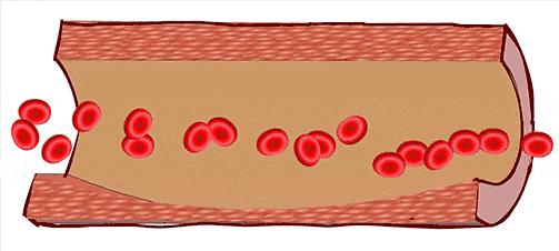 蜱虫会整个钻入身体吗,吸血蜱虫究竟有多可怕