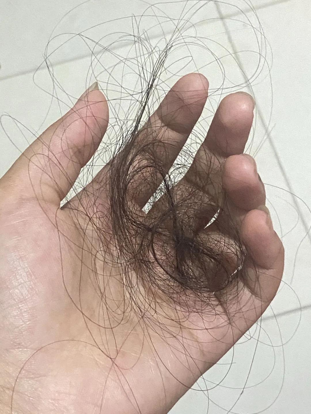 为什么我每天掉头发但还是没秃,总是掉头发快秃了怎么办