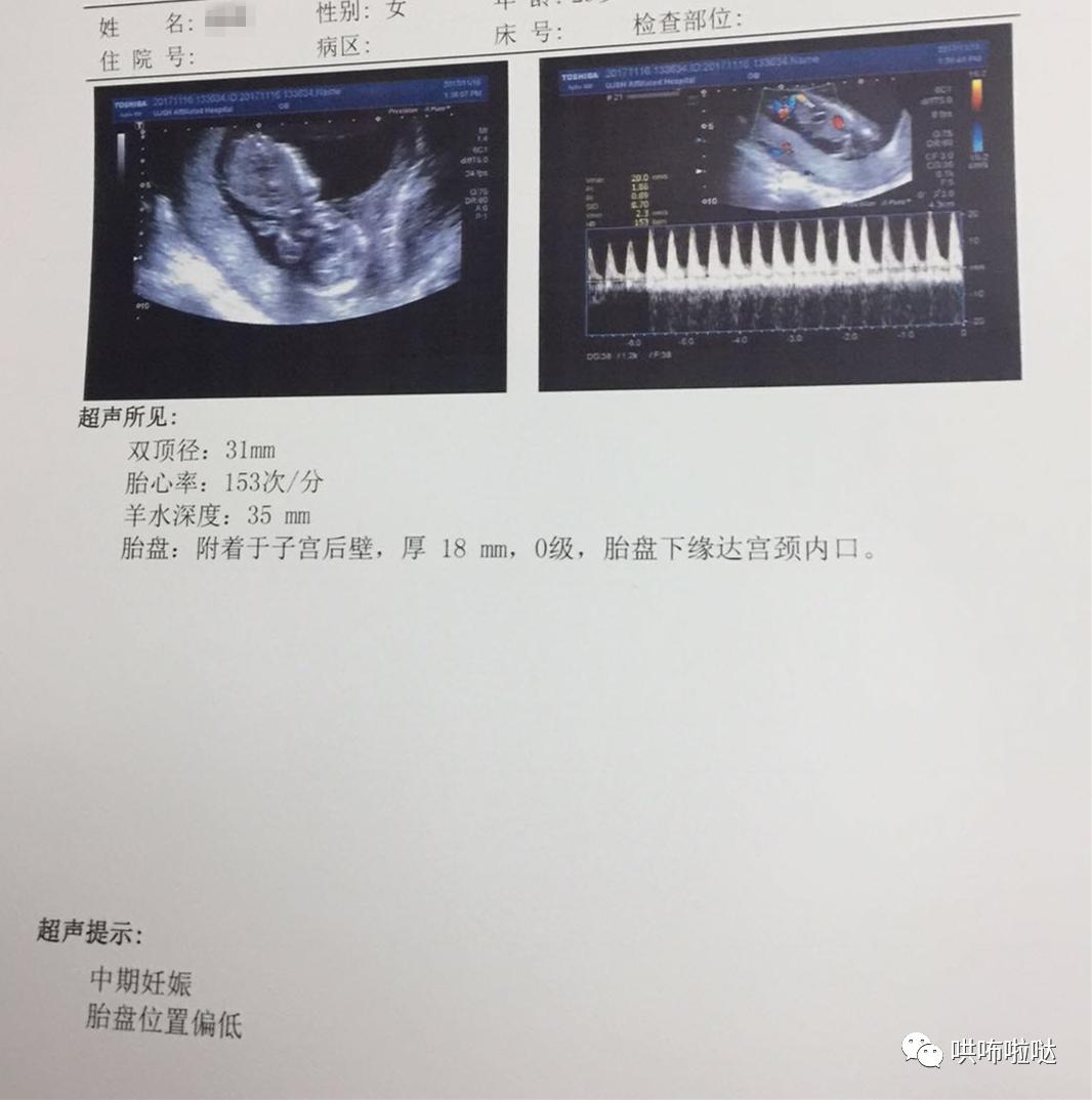 怀胎十月终于要卸货,回忆一下刚出生的宝宝