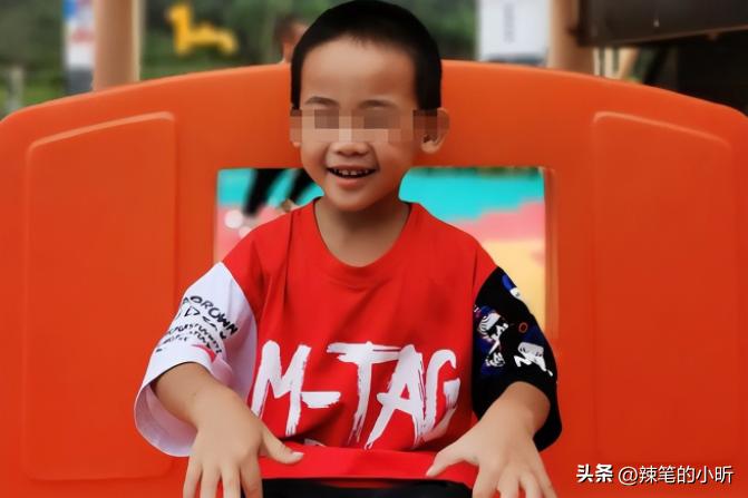 被泼硫酸毁容16岁女生,2017年18岁少女被泼硫酸毁容