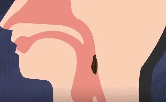 如果水蛭接触到沙子会怎么样,如果水蛭钻人血管会怎样