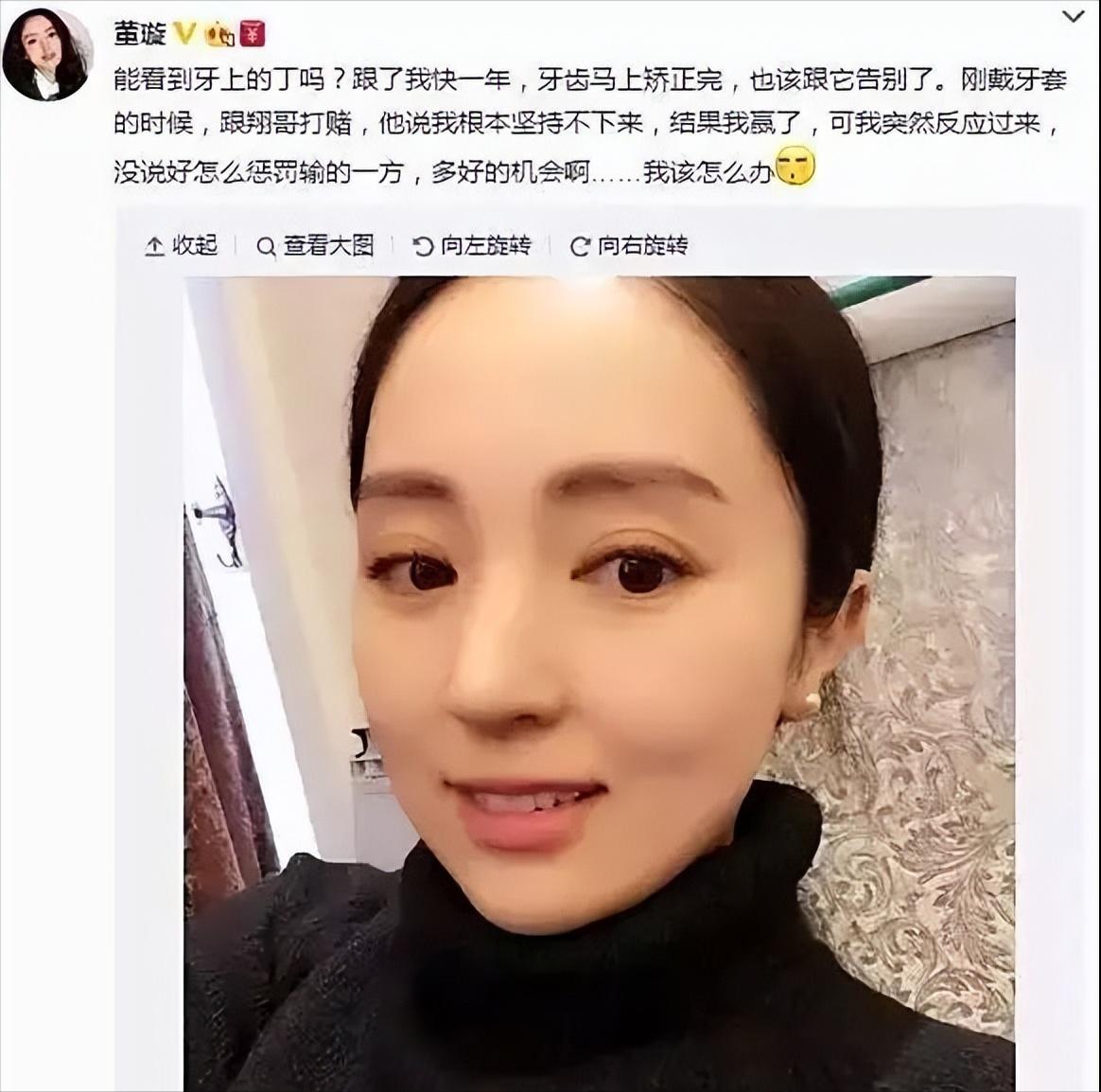 明星的牙都很齐吗,明星的牙齿都很好看