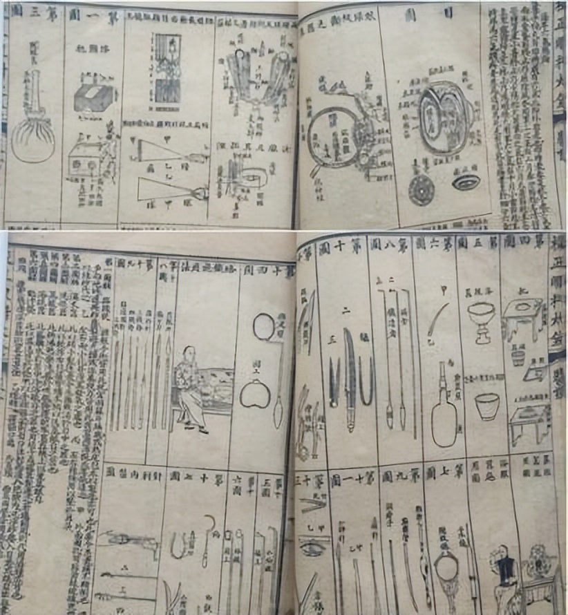 五千年前神奇开颅术,500年前开颅手术神秘巫术