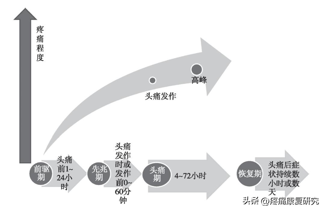 中国偏头痛防治指南2023年版,偏头痛诊治规范最新版