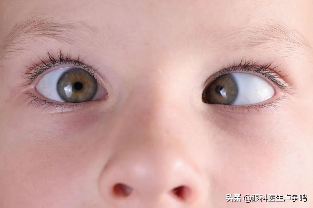 “两只眼睛度数不一样”是视力危险信号，得注意