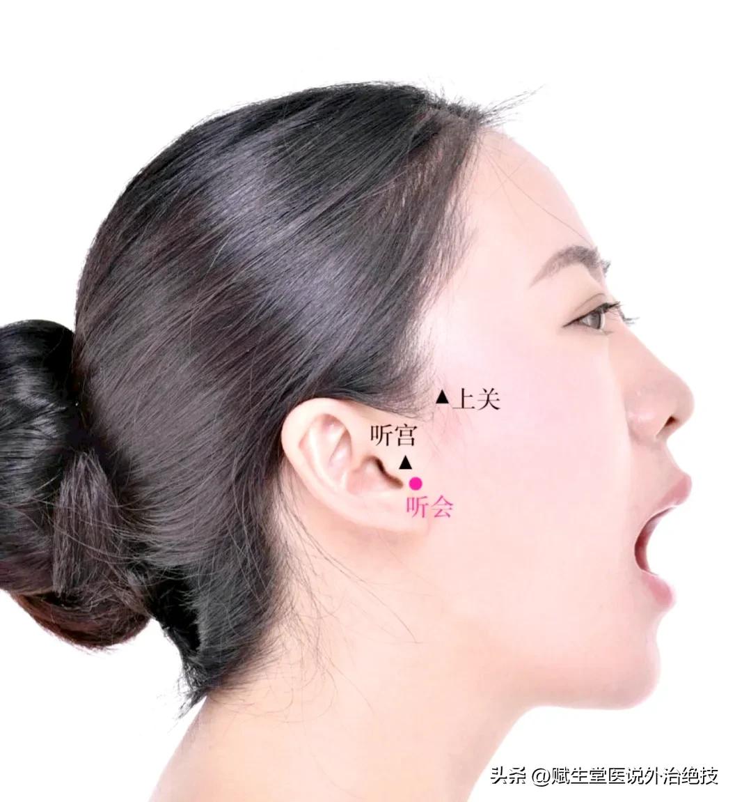 耳鸣按什么穴位最好,耳鸣怎样选药