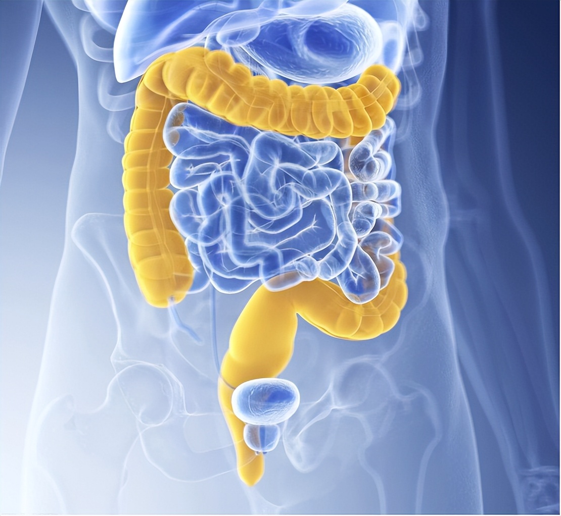 怎么判断粪便是不是宿便,如何排出体内黑色的宿便