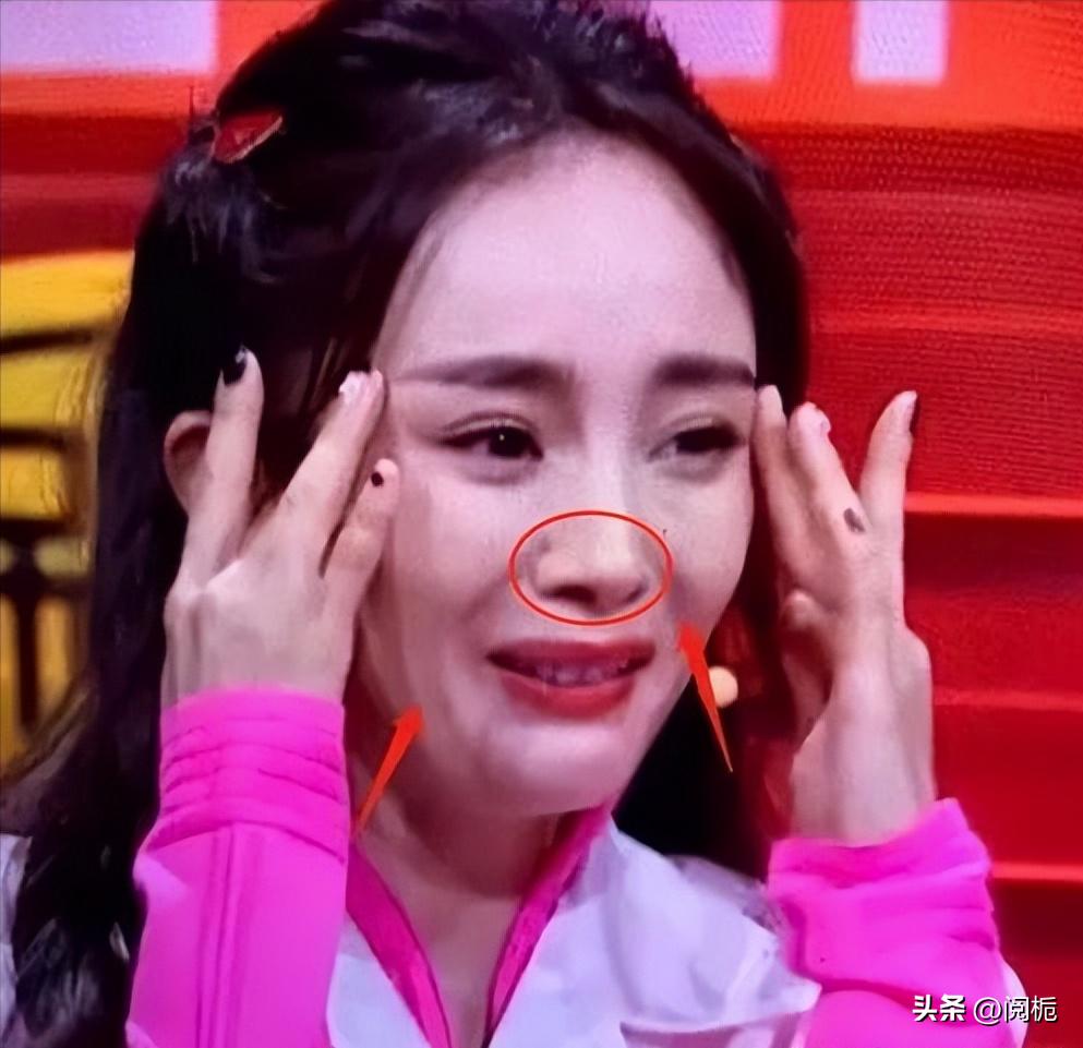 瘦到病态的审美,瘦到病态畸形审美太可怕