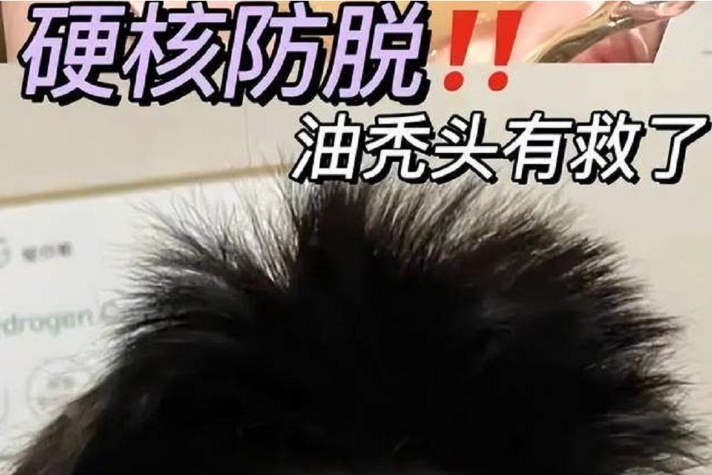 修正防脱固发洗发露评测,哪几款洗发露最好用不会秃头