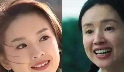 明星做烤瓷牙变凸嘴,明星烤瓷牙凸嘴