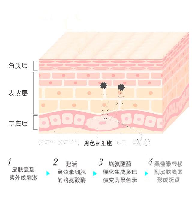 日光灯会导致皮肤变黑吗,日光灯会把人晒黑吗