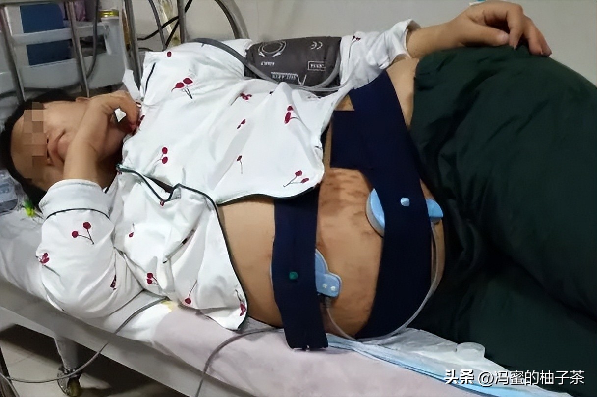 2009年湖南女子生下重2斤小猴子,湖南女子生了个小猴子上综艺节目