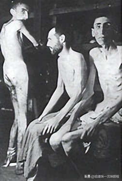 纳粹对犹太男人做绝育实验,纳粹犹太人绝育手术