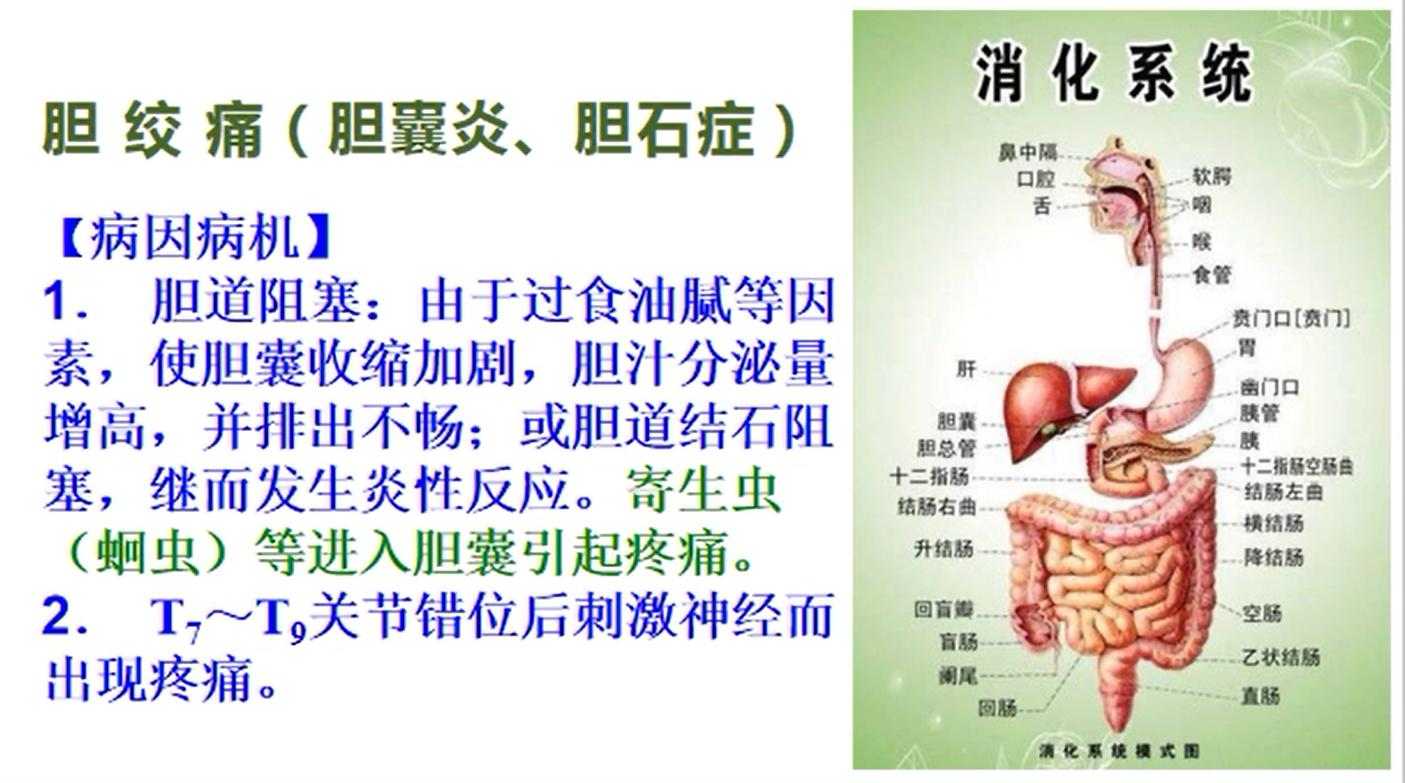 胆结石胆囊炎最佳治疗方法中医,胆囊炎胆结石保守治疗方法