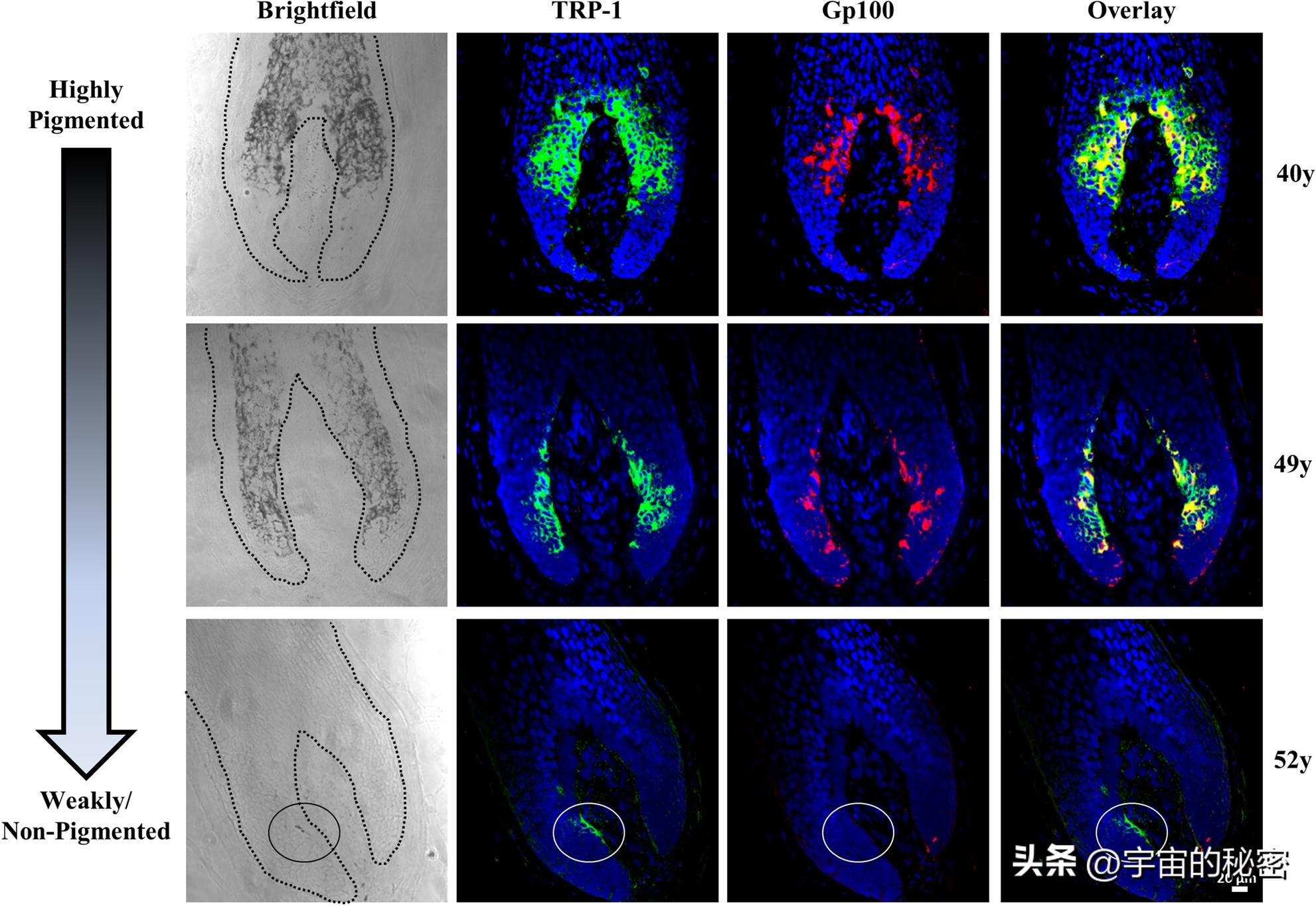 黑奥秘真的让白发变黑吗,白发变黑黑科技