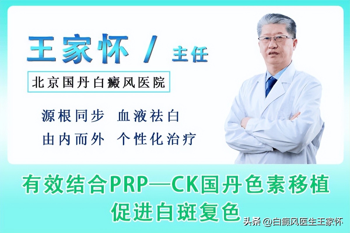 白癜风复色后怎么控制不复发,白癜风白斑复色后会容易复发吗