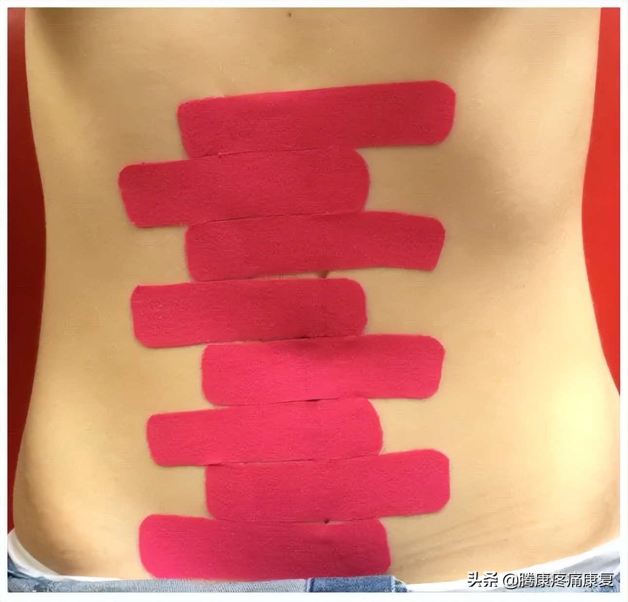 产后腹直肌分离康复训练方法,腹直肌分离的康复动作