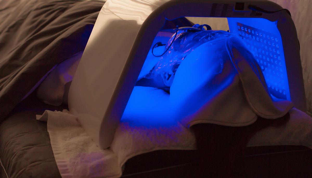 冯小刚的白癜风能治吗,冯小刚患白癜风视频