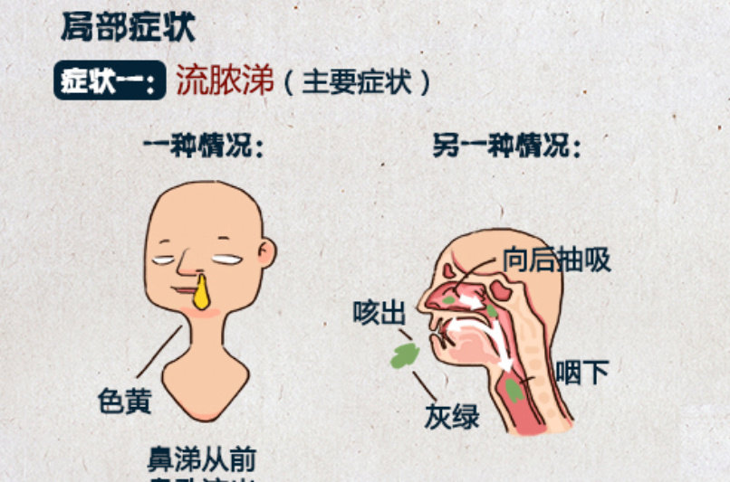 儿童鼻窦炎用药一般多久能好,儿童鼻窦炎抗生素的用法
