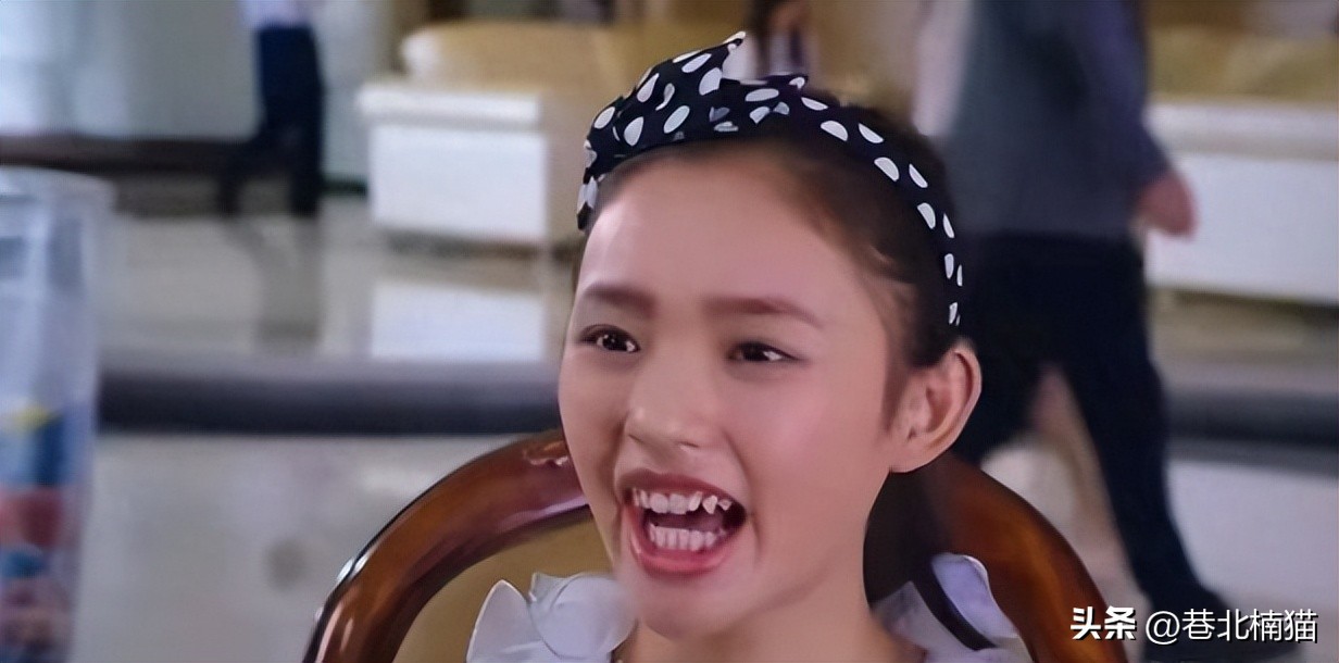 明星嘴突戴牙套前后对比,明星和假牙