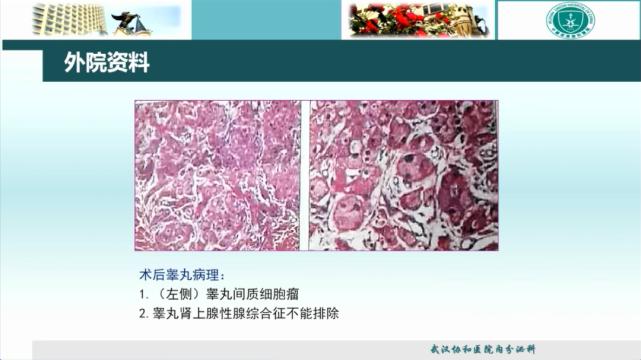 病例分享科普文章,最易误诊的经典病例分享