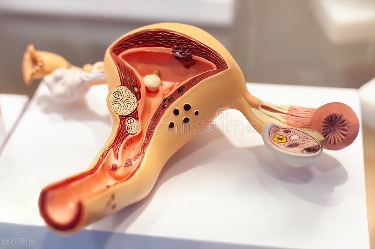 体检发现卵巢囊肿会恶变吗,体检发现卵巢囊肿怎么治疗