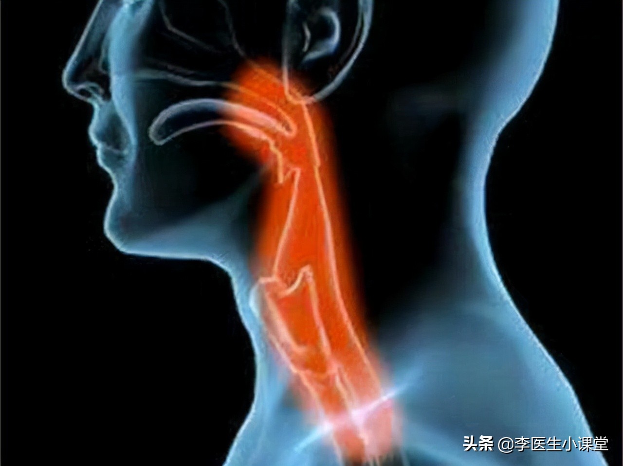 阿莫西林被误用,警惕阿莫西林千万不能随便吃