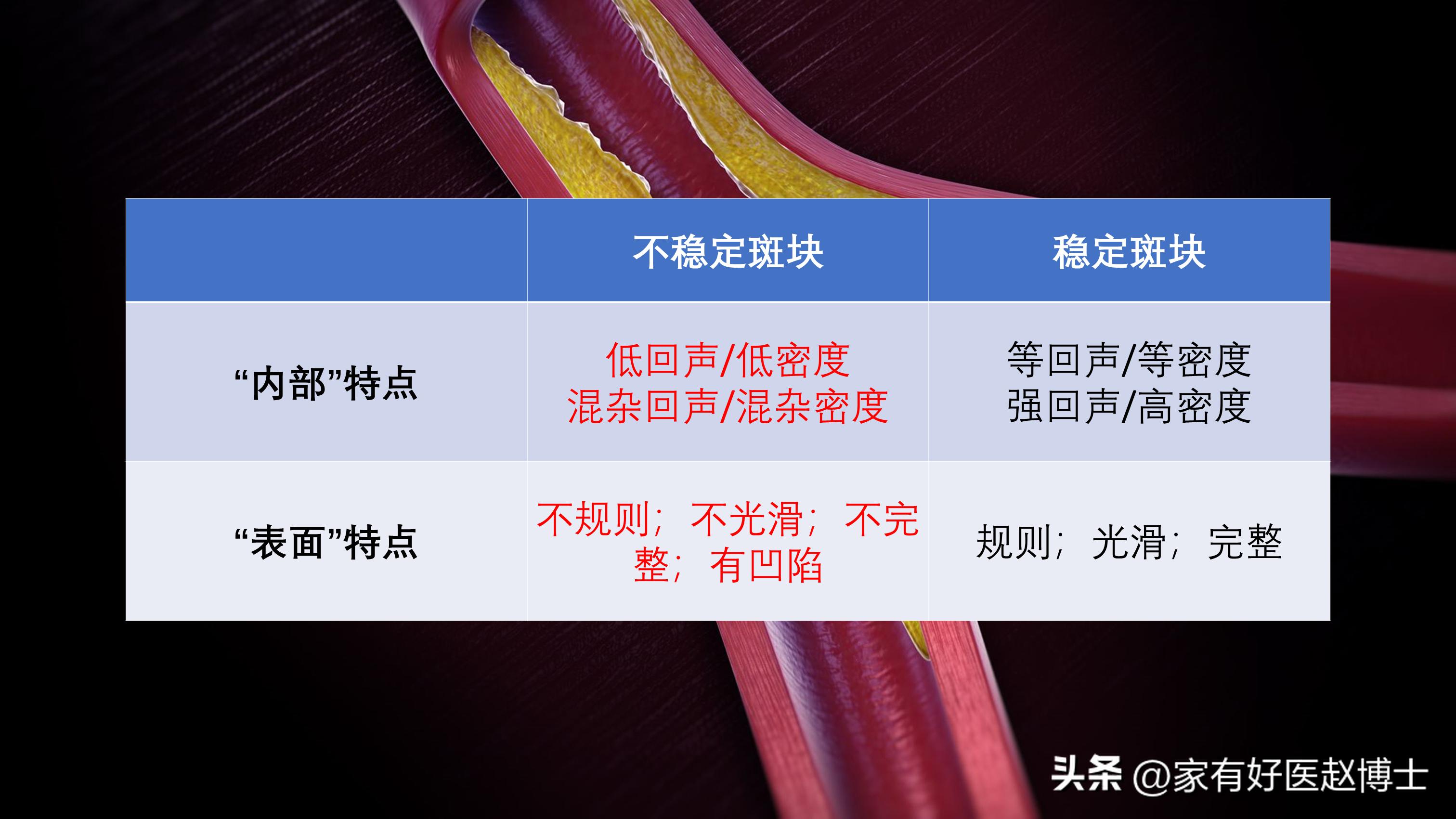 有动脉斑块必须要吃阿司匹林多久,有颈动脉斑块吃阿司匹林可以吗