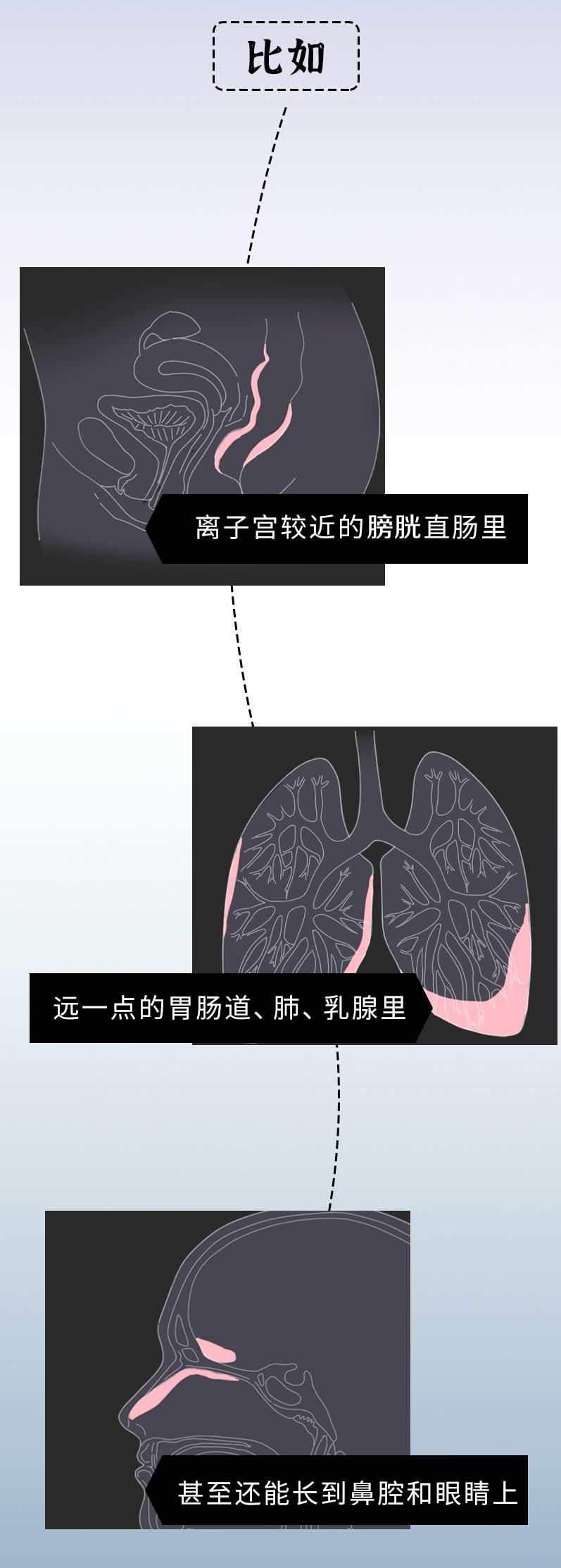 女子每月痛经,女性痛经5年加重