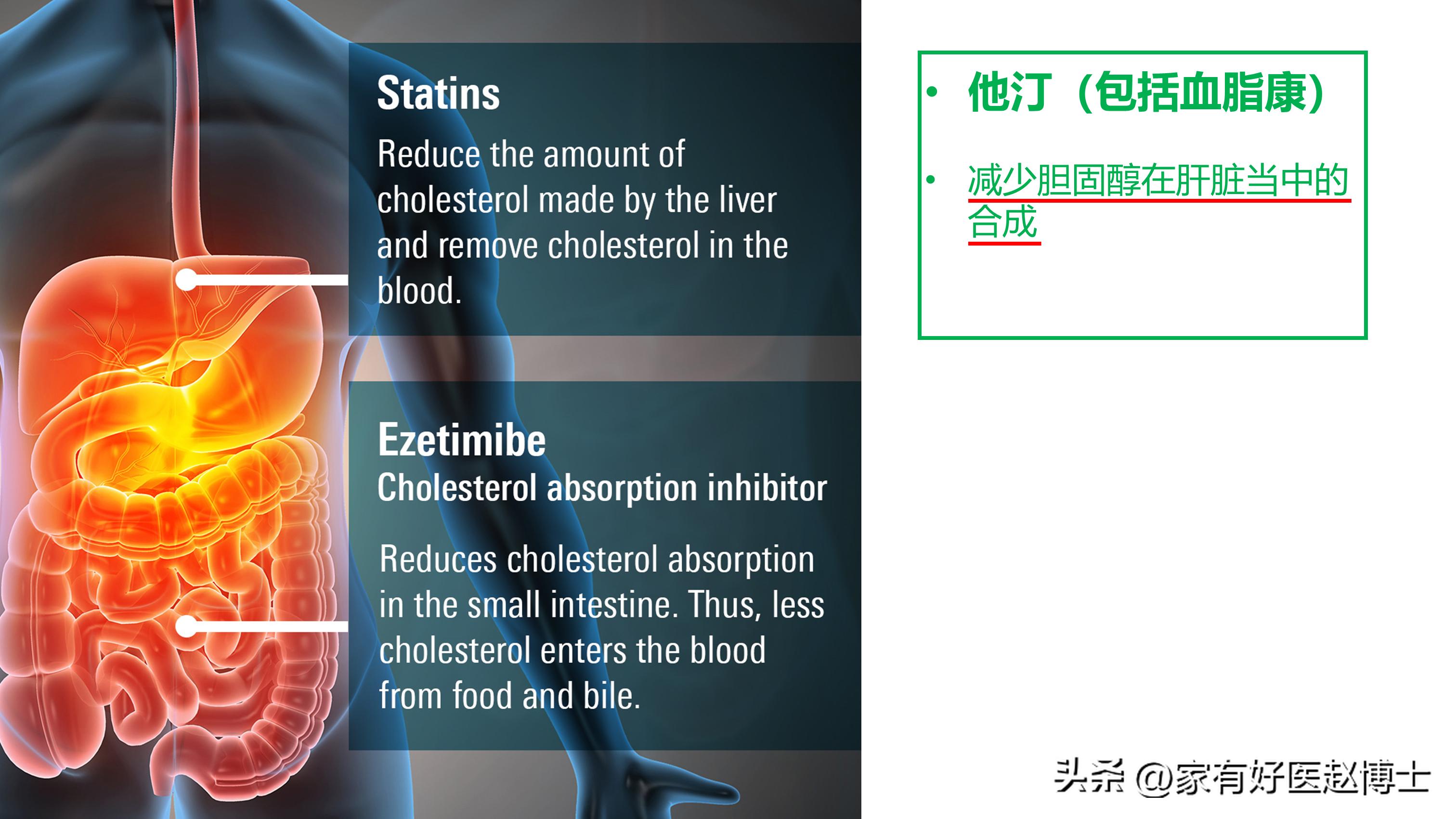 他汀药与依折麦布能同服吗,他汀和血脂康一样有效吗