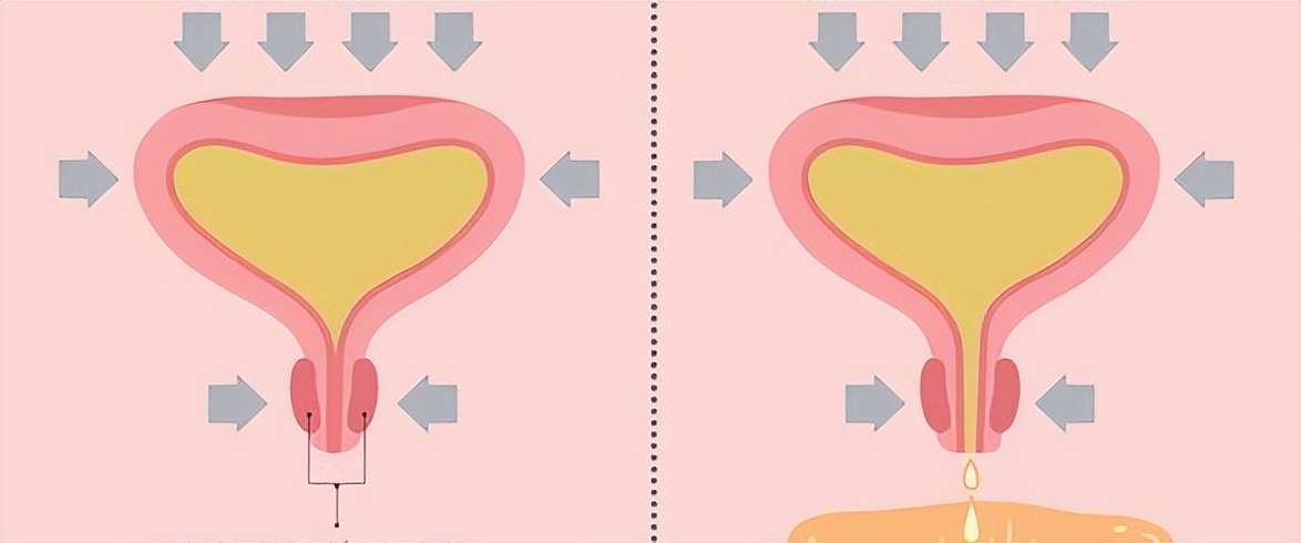 婆媳俩共赴门诊，只因这难言之隐