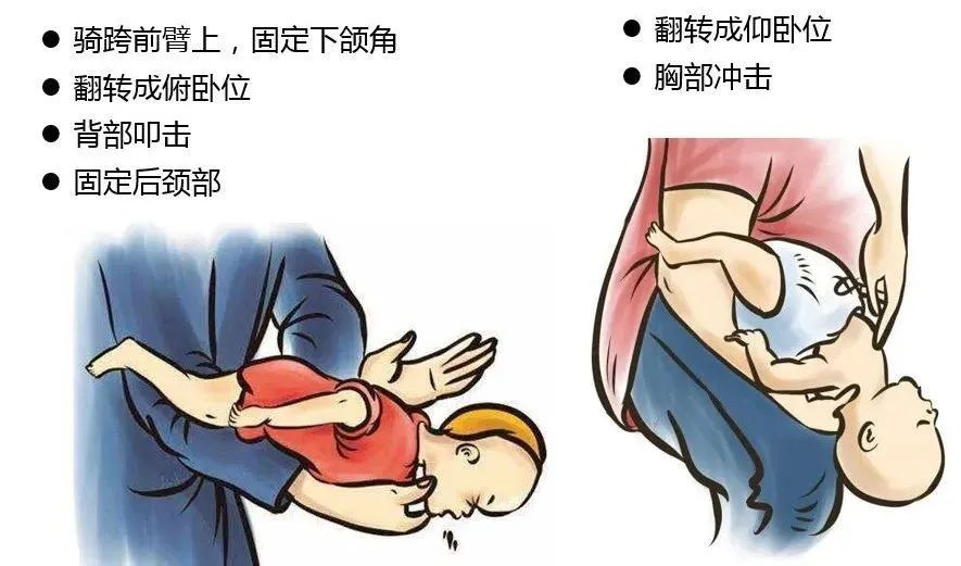 不小心异物卡喉了怎么办,不小心被卡住怎么自救