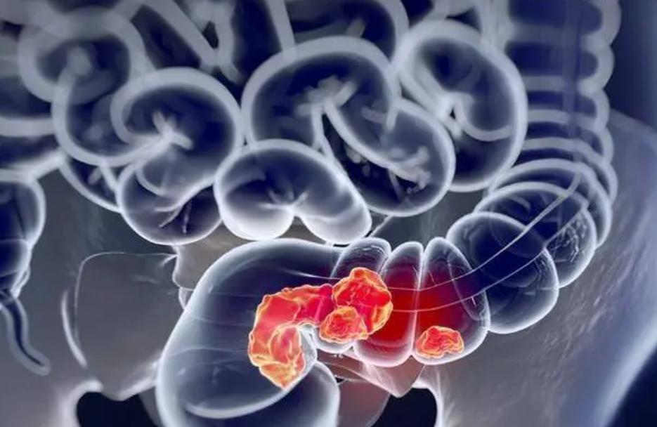 男医生做肠镜检查吗,男医生做肠镜会难为情不