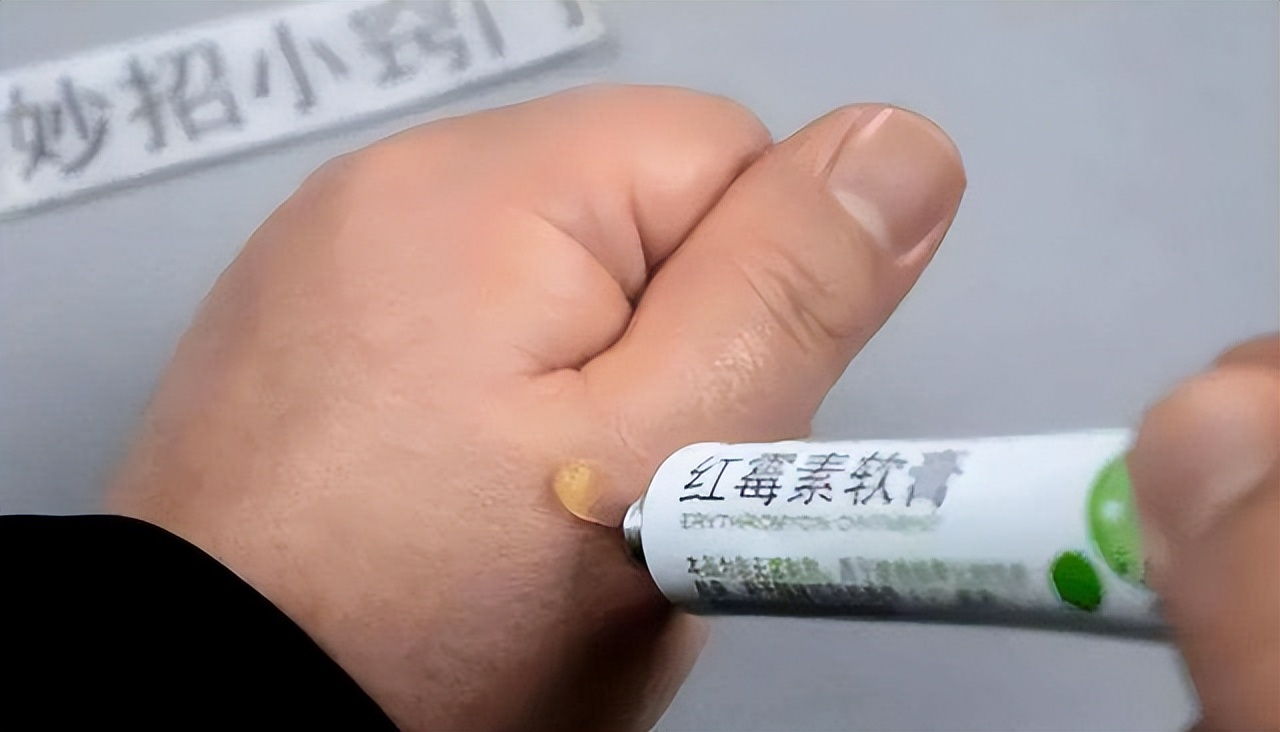 淡斑祛斑小妙招红霉素软膏,两块钱的红霉素软膏淡斑