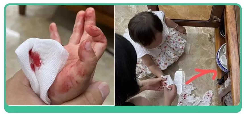 三岁女童玩筷子导致双手被锯,四岁女童不锈钢筷子切掉9根手指
