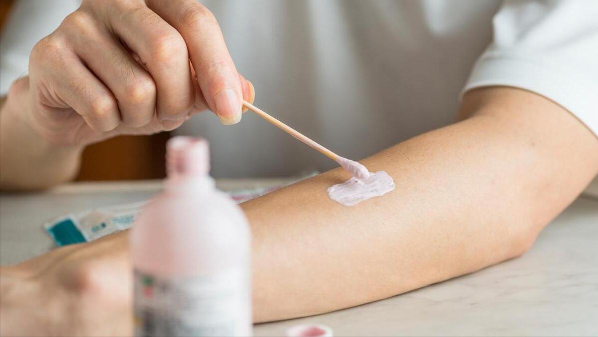 炉甘石洗剂多钱,不同牌子的炉甘石洗剂功效一样吗