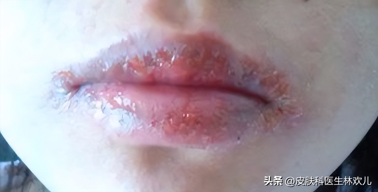 唇膏能舔吗有什么危害吗,唇膏能用舌头舔吗