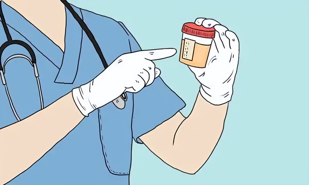 小便浑浊是什么原因中医解释,早上第一泡尿浑浊肾有问题