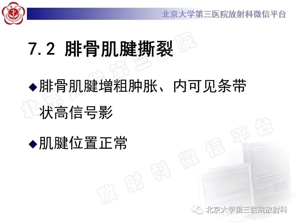 好文分享续集,腓骨肌腱脱位手术价格