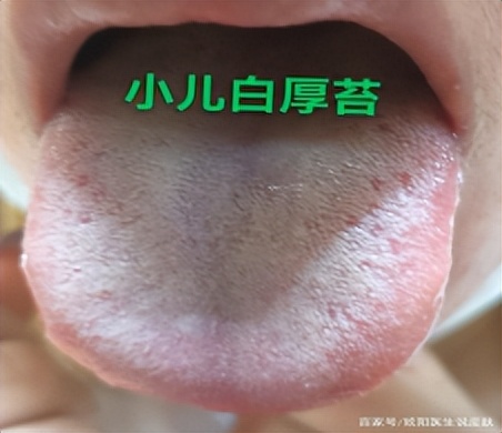 小儿豉翘清热颗粒影响新冠疫苗吗,小儿豉翘清热颗粒新冠肺炎