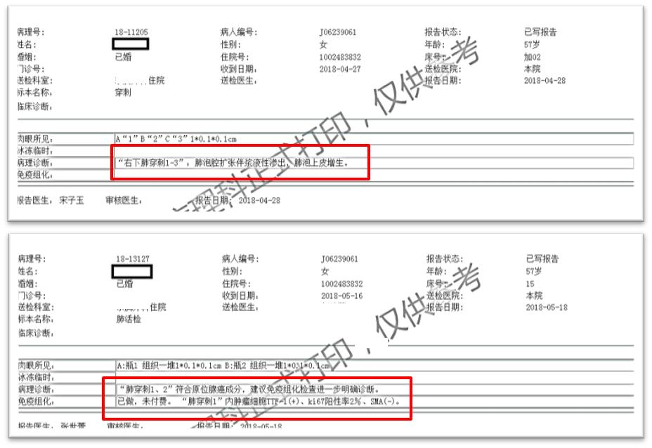 肺高危磨玻璃结节怎么治疗最好,肺磨玻璃结节影微创手术