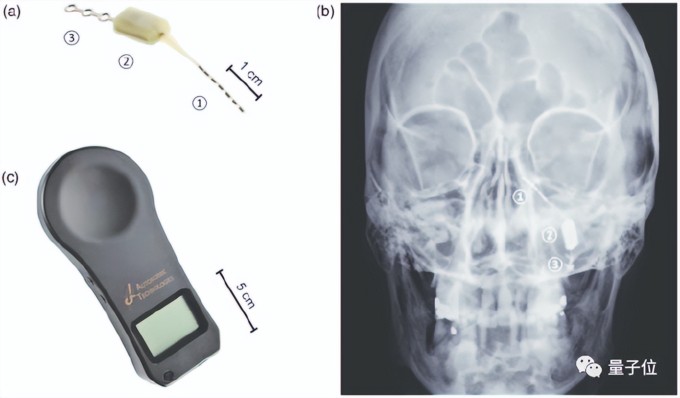 植入式设备制造商破产，患者无语，自行购买零件维护修理