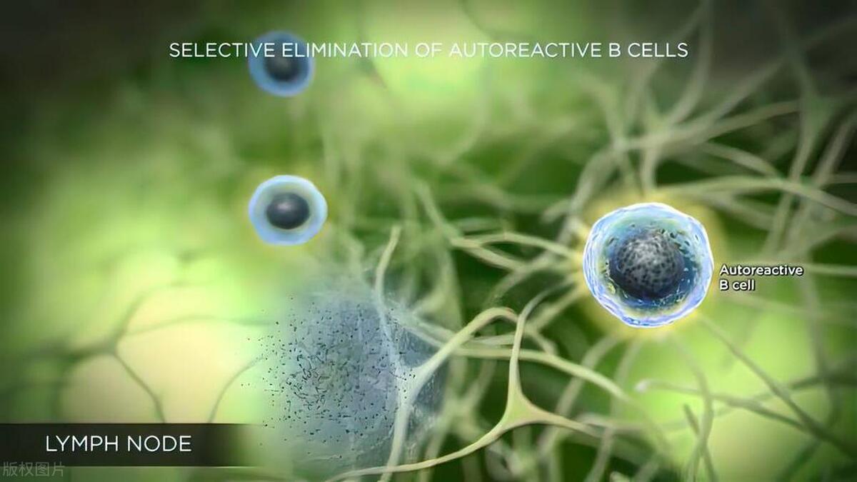直肠癌转移就是晚期了吗？直肠癌晚期会出现哪5个临床表现？