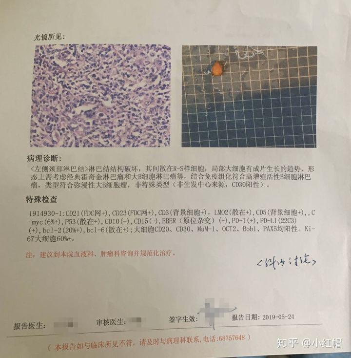 最可怕的癌症复发方式,癌症复发恐惧