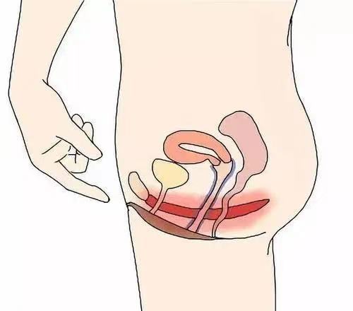 谜一般的疼痛，被谜一般地治好了